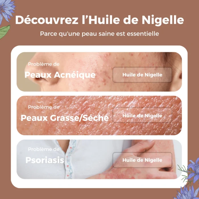 HUILE DE NIGELLE D'ÉTHIOPIE - 100ML – Image 5
