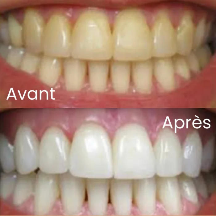 SIWAK NATUREL - HYGIÈNE DENTAIRE TRADITIONNELLE – Image 5